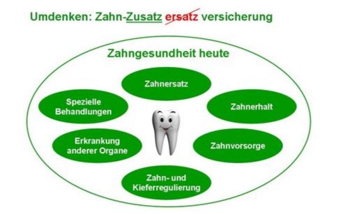 Leistungen bei der Zahnzusatzversicherung